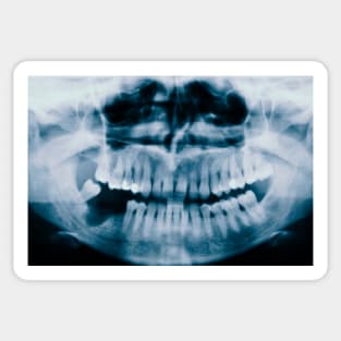 X-Ray Teeth Sticker